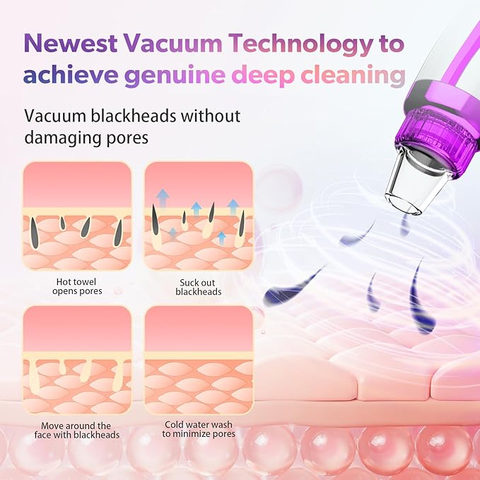 Blackhead Remover Pore Vacuum, Blackhead Vacuum, Facial Pore Cleaner with 5 Adjustable Suction Levels, 5 Probes, USB Rechargeable Pore Cleaner, Electric Comedone Whitehead Extractor Tools Kit