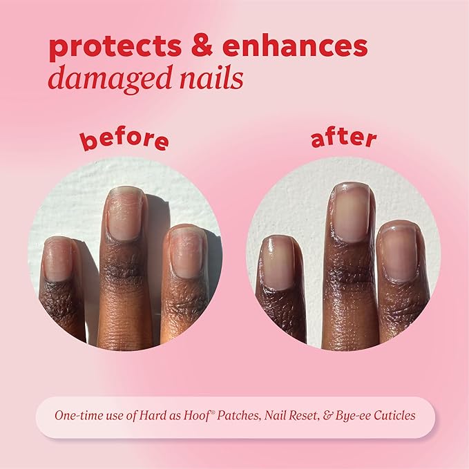 Onyx Professional Hard as Hoof S.O.S Nail Patches - Nail and Cuticle Strengthening Treatment Repair Patches, Nail Growth, Repair, 20 Count