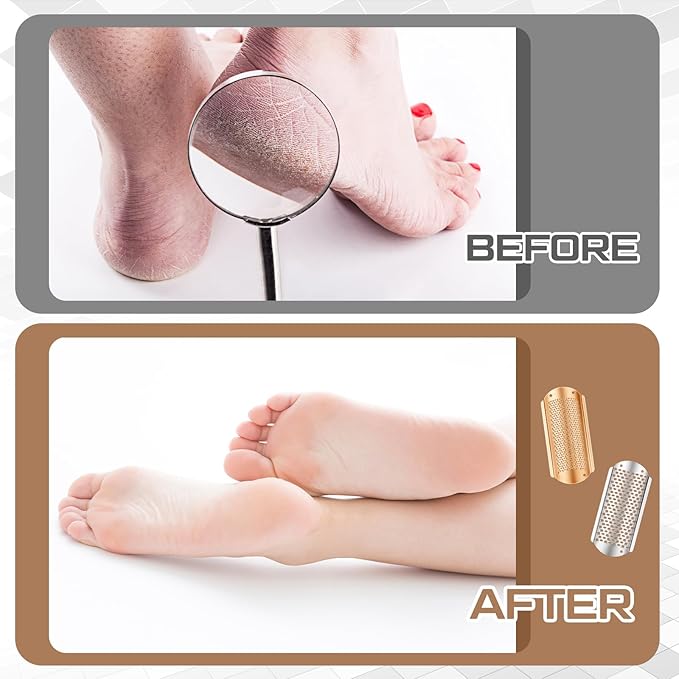 Moxweyeni 8 Pack Rose Gold,Silver Foot File Callus Remover Replacement Blades Metal File Callus Remover Hard Skin Remove Stainless Steel 2 Designs Big/fine Hole for Detachable Foot Scrubber
