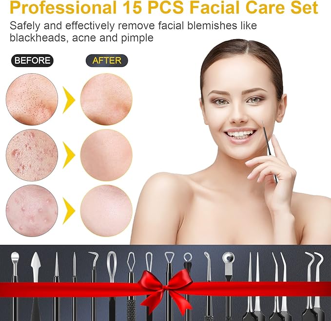 Pimple Popper Tool Kit, IUMAKEVP 15 PCS Professional Stainless Steel Blackhead Remover Comedone Extractor Tools for Removing Pimples, Blackheads, Zit on Face - Acne Removal Kit with Metal Case (Black)