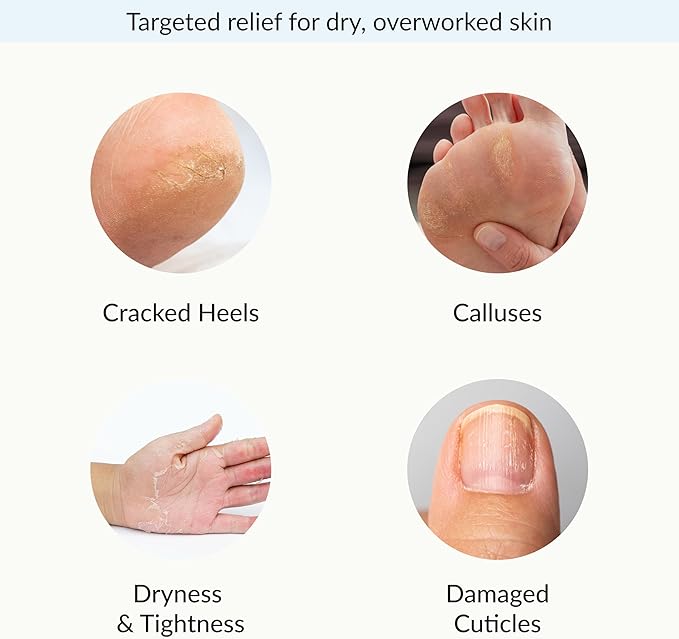 Epielle Intensive Repairing Hand & Foot Masks, Restore and Moisturize Dry, Cracked Skin, Self Care Gifts for Women, Spa Kit, Easter Basket Stuffers, 6 Moisturizing Gloves & 6 Moisturizing Socks