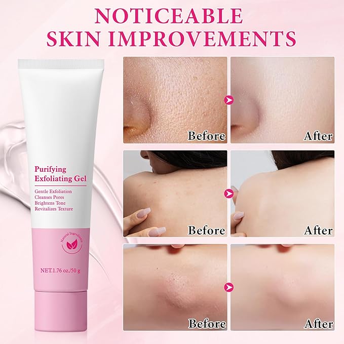 Purifying Exfoliating Gel, 2 Pack Face Facial Exfoliator Cleanser, Gentle Face Scrub Exfoliating Gel Purifying for Facial & Body Deep Cleansing, Regulates Water & Oil Balance, Smoother & Softer