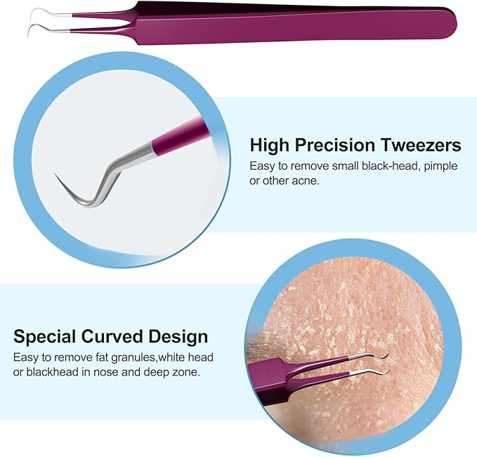 Blackhead Remover Tools, Face Scraper for Deep Cleaning, Pimple Popper Tool kit, Skin Scrubber Face Spatula, Skin Care Tool for Men and Women (Rose red)