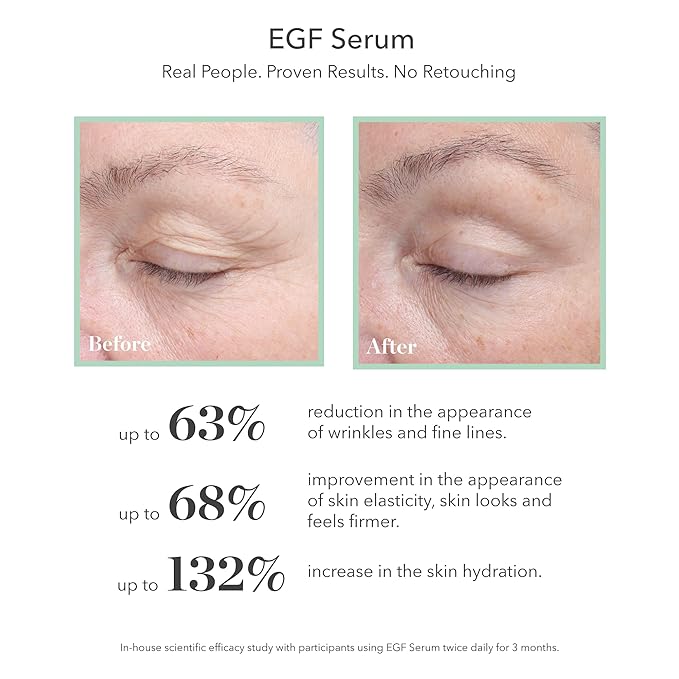 BIOEFFECT EGF Serum | Epidermal Growth Factor + Hyaluronic Acid | Age-Defying Face Treatment for Fine Lines & Wrinkles, Hydration & Firmness, 15 mL / 0.50 oz