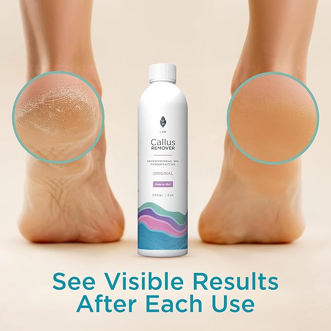 Lee Beauty 8oz Professional Gel Callus Remover for Feet - Original Fast-Acting Formula, Extra Strength for Cracked Heels & Dead Skin (Pack of 1)