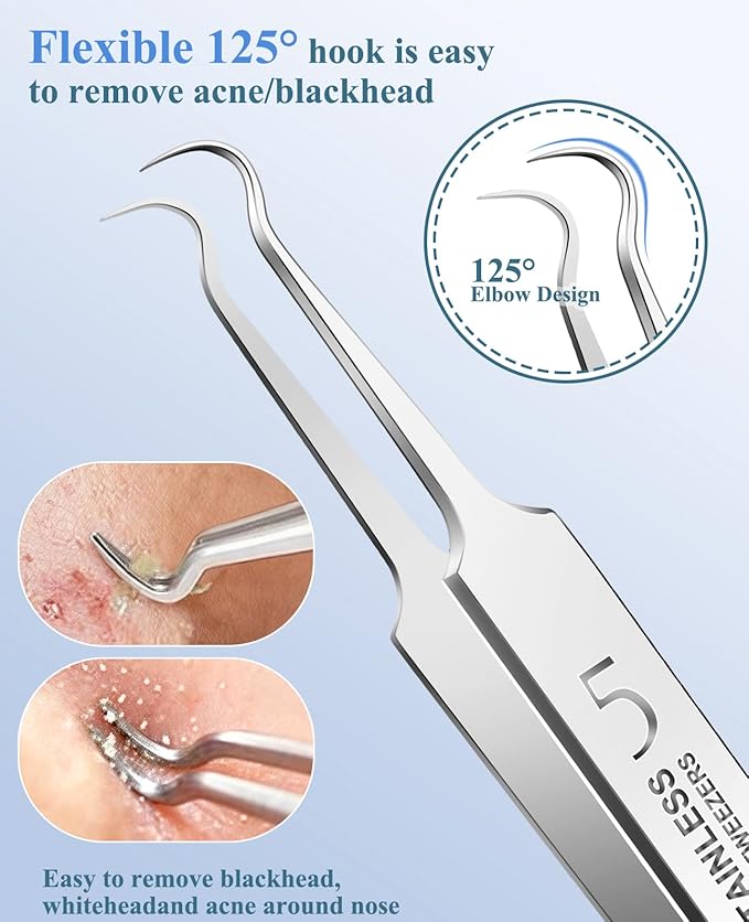 3PCS Pimple Extractor Acne Treatment Tool Professional Stainless Blackhead Comedone Removal Popper Tool for Face Nose Blackhead Extractor Tool (Silver)