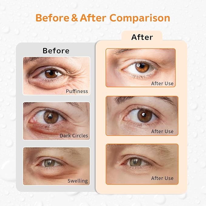 4PCS Gel Eye Ice Pack Set, Cold & Hot Compress, Reusable Cooling Gel Pads for Strain Relief, Relaxation, SPA and Sleep (4 Orange Flowers)