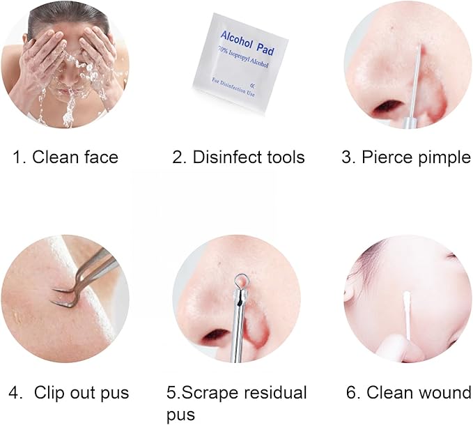 FIXBODY Blackhead and Splinter Remover Tools - Stainless Steel Professional Easily Cure Pimples Whiteheads Comedones Acne Zit Ingrown Hairs and Facial Impurities Bend Head Tweezer Surgical Kit