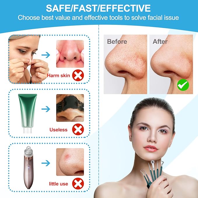 Blackhead Remover Tools Pimple Popper Tool Kit Comedones Extractor Acne Removal Kit for Whitehead, Blemish, Popping. 5pcs Pimple Extractor with Blackhead Tweezers for Nose Face