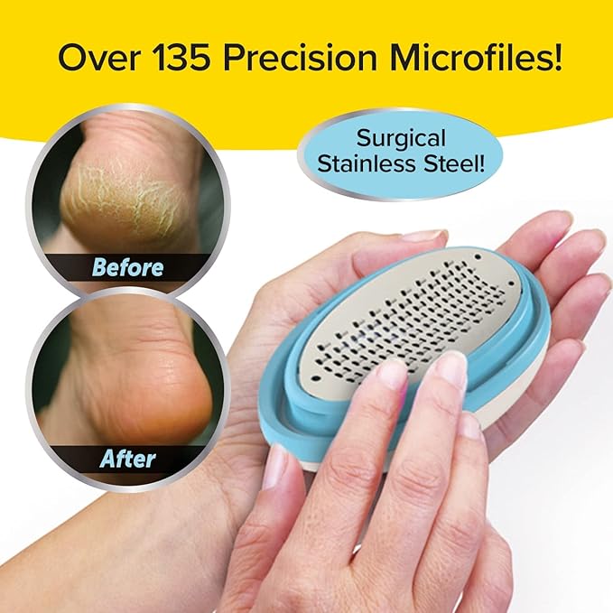 PedEgg Foot File – Traps Shavings Inside for Mess-Free Use – Painless Callus Remover with Ergonomic Handle for Tough, Dry Skin & Smooth, Soft Feet