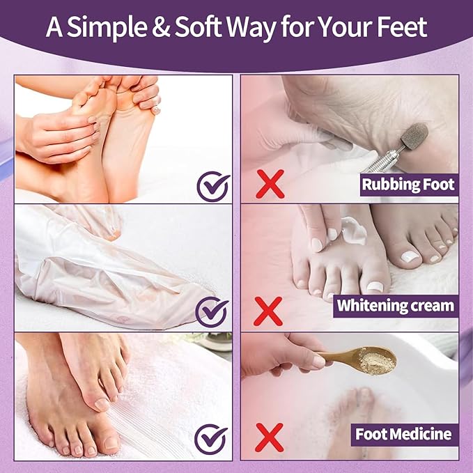5 Pack Moisturizing Foot Mask,Hydrating Foot Masks for Dry Cracked Feet,Moisturizing Socks Dry Skin Moisturizer for Soft and Smooth Touch Feet,Foot Care Spa Gifts for Women Men Easter Basket Stuffers