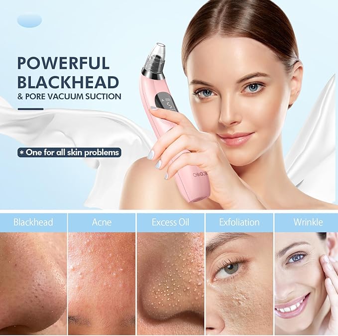 Blackhead Remover Pore Vacuum with Camera - Upgraded Black Head Remover for Face, Electric Acne Comedone Whitehead Extractor Tools - 5 Modes, 3 Probes, Pimple Popper Tool Ki