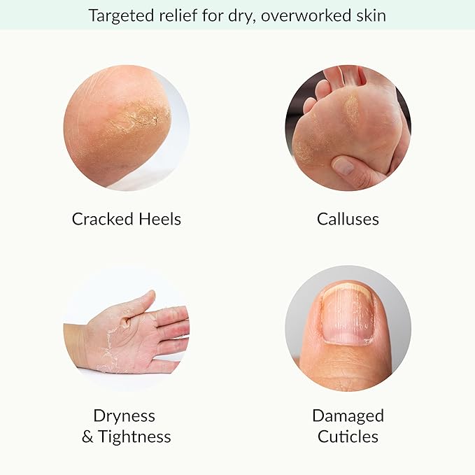 Epielle Relaxing & Nourishing Hand & Foot Masks, Soften Dry, Overworked Skin, Self Care Gifts for Women, Spa Kit, Easter Basket Stuffers, 6 Moisturizing Gloves & 6 Moisturizing Socks