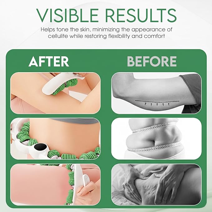 Cellulite Massage Roller, Fascia Blaster, Lymphatic Drainage Massager, Relieve Muscle Soreness, Body Sculpting Tool with Detachable Handles for Thighs, Legs, Buttocks, Gift Exfoliating Brush. (Green)
