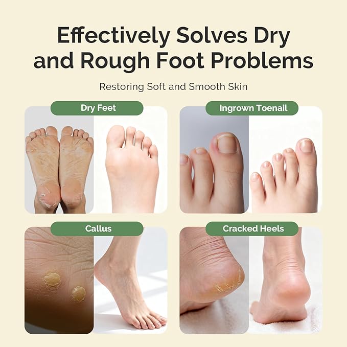 MelodySusie Tea Tree Oil Foot Soak with Sea Salt - Moisturizing Pedicure Treatment for Softening Calluses & Soothing Tired Feet - 16oz Relaxing Foot Bath to Refresh & Rejuvenate 1 Pound