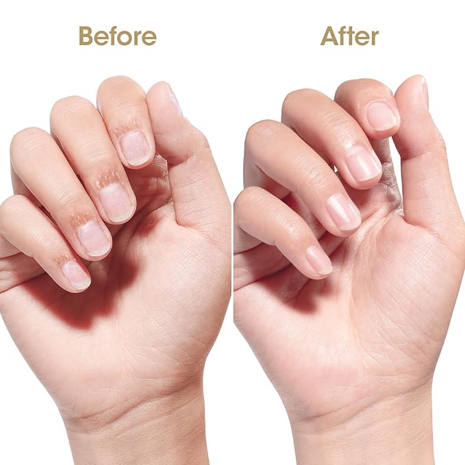 GELLEN Nail Growth Oil, Nail Cuticle Oil for Growth and Strength, Vitamin E Natural Keratin Cuticle Nails Treatment for Hydrating, Nourishing, Strengthening, Repairing, 0.68 Oz