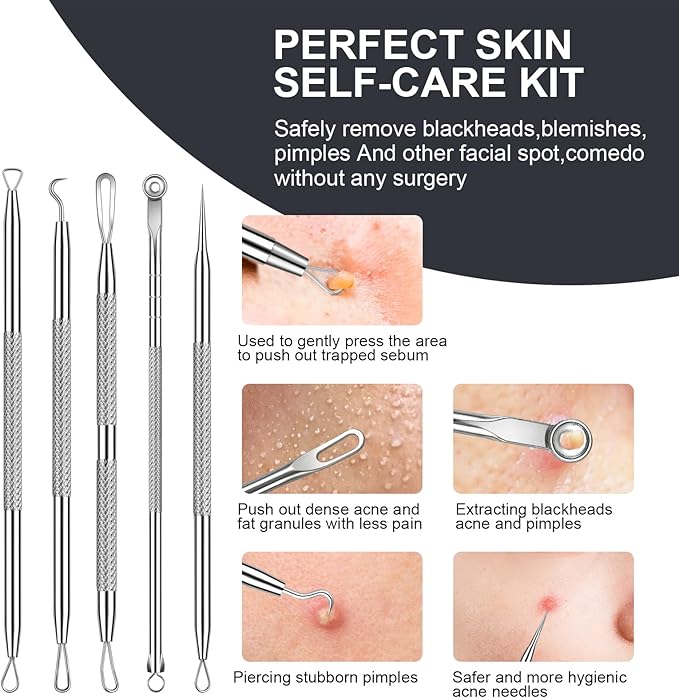 Pimple Popper Tool kit Blackhead Remover Comedone Extractor Kit with Box for Easily Remove blackheads, Acne, Blemishes, Whiteheads, pimples and Papules from the face and Bonus Gift -7pcs