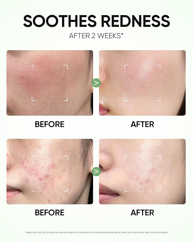 Mugwort Clay Stick Mask for Face, Redness Soothing & Breakout Control with Centella and Salicylic Acid, Gentle Exfoliating, Vegan Skincare, Wash-Off Facial Mud Mask