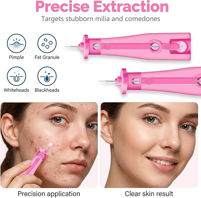 100Pcs Sterile Lancets for Pimples - Disposable Pimple Extractor Tools, Portable Acne Blackhead Remover Tools for Travel & Sensitive Skin, Sterile Acne Needles for at-Home Skin Care