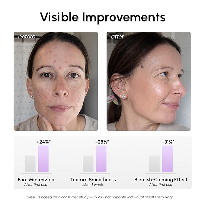 MAREE Niacinamide Toner Pads for Face – Exfoliating Pads with 12% Niacinamide, Salicylic Acid, Hyaluronic Acid & Tea Tree – Zero Pore, Uneven Skin Tone, Acne Clearing Facial Pads – Glow Up Device