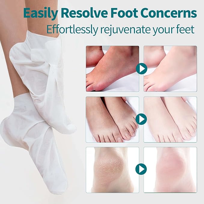 5 Pack Moisturizing Foot Mask,Hydrating Foot Masks for Dry Cracked Feet,Moisturizing Socks Dry Skin Moisturizer for Soft and Smooth Touch Feet,Foot Care Spa Gifts for Women Men Easter Basket Stuffers