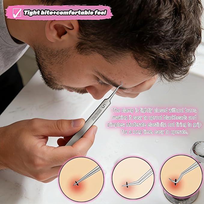 Professional Blackhead Remover Tweezers Set, Stainless Steel Pimple Extractor Tool Kit with Straight, Angled and Curved Tips, 3 Piece Set with Storage Case