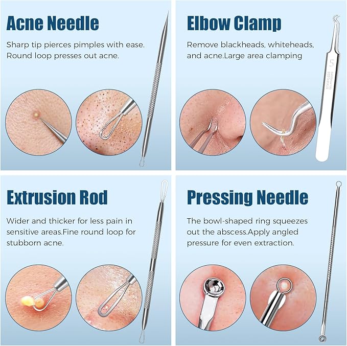 Blackhead Remover Tool Kit, 6 Pcs Pimple Popper Comedone Extractor Set with Acne Needles, Tweezers, Pore Scraper for Blemish, Zit, Whitehead Removal on Nose and Face, with Storage Case