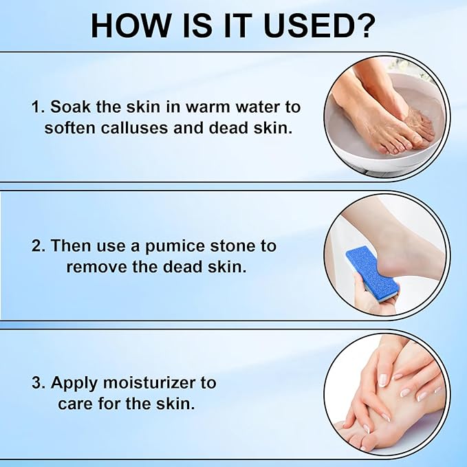 Foot Pumice Stone 4 Pack Pedicure Stone for Feet Pumice Sponge for Feet Callus Remover and Scrubber Double Sided Pedicure Foot Pumice Stone for Feet and Heels Callus and Dead Skins (Blue)