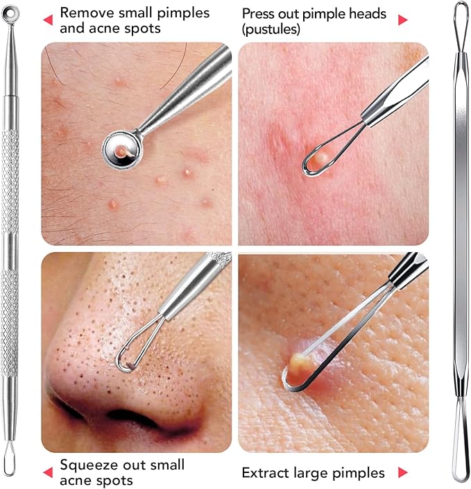 Litbear 6 Pcs Blackhead Remover Tools,Pimple Popper Tool Kit,Blackhead Pimple Comedones Extractor,Acne Tools Extractor kit, Scraper for Face Nose Deep Cleansing with Leather Case
