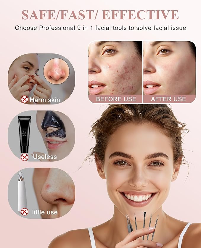 5PCS Blackhead Remover Pimple Popper Tool Kit, Professional Stainless Pimple Acne Blemish Removal Tools Kit for Face (Black)