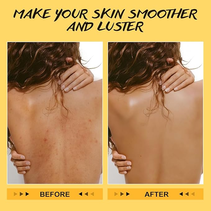 POP MODERN.C Turmeric and Vitamin C Body Scrub Remove Dead Skin Improve Dark Spots Acne Natural Organic Exfoliating Deep Cleansing Exfoliator for Body Butt Bikini Area Body Care with Loofah