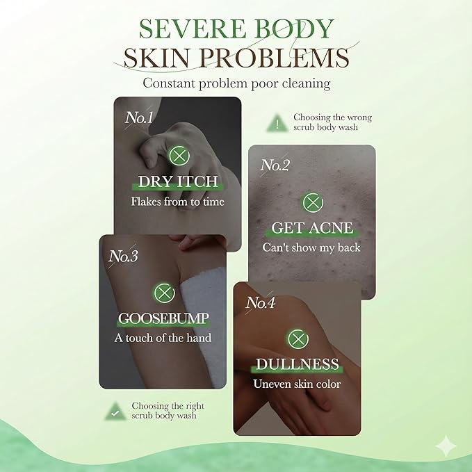 Kiwi Fruit Exfoliating Body Wash - [300ml] Vitamin C Brightening Shower Gel with Natural Seeds - Mild Body Scrub for Strawberry Legs & Rough Skin - Refreshing Scent