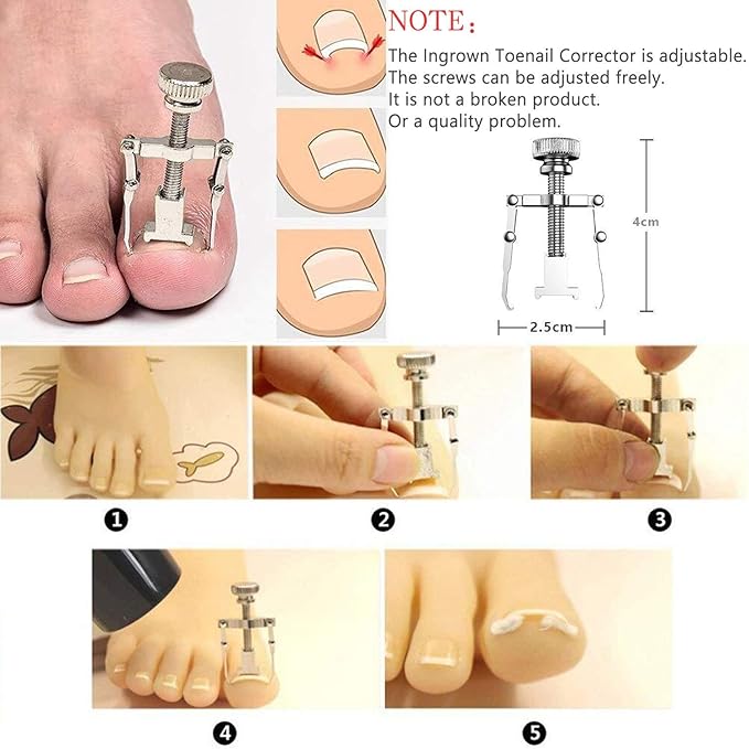 JTIEO Toenail Clippers 12-Piece Nail Treatment Foot Tool, Ingrown Toenail Removal Correction Clippers, Surgery Grade Nail File Lifter, Professional Pedicure Tool.