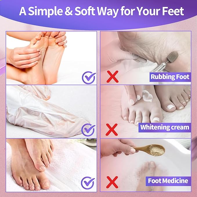 5 Pack Moisturizing Foot Mask,Hydrating Foot Masks for Dry Cracked Feet,Moisturizing Socks Dry Skin Moisturizer for Soft and Smooth Touch Feet,Foot Care Spa Gifts for Women Men Easter Basket Stuffers