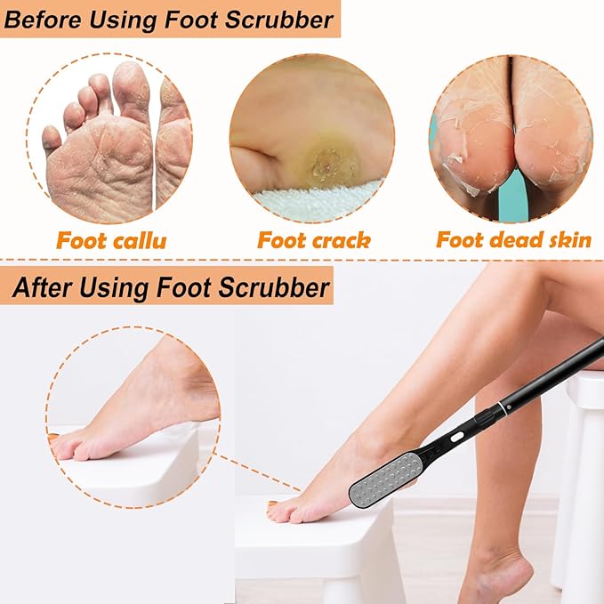 Toe Cleaning Brush, 18.8"-25.9" Telescopic Long Handle Foot Brush,Foot File for Feet Care Remove Hard Skin for Seniors,Men and Women