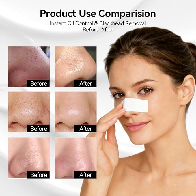 LANBENA 120 Pcs Nose Mask Strips Paper, Compatible with LANBENA Blackhead Remover Peel-Off Mask, Accessories for Blackhead Removal