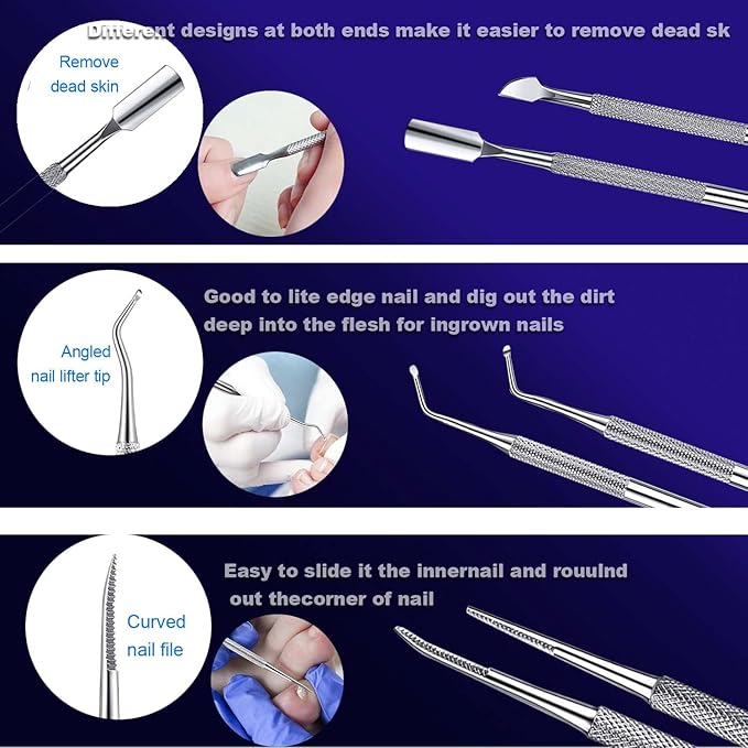 Ingrown Toenail File and Lifters Set(6pcs), Professional Pedicure Tool Toenail Grooming Kit, Ingrown Toenail Treatment Pedicure Kit, Under Nail Cleaner Tools (6PCS)