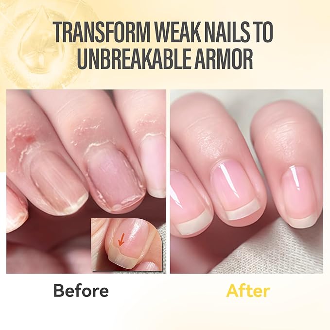 CHUCHU Nail Growth and Strengthener Oil for Cuticle - Orange Scent Cuticle Oil Repair Moisturizing Treatment - Natural Jojoba Vitamin B & E Nail Oil for Dry Cracked Nails