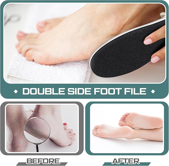 Lothee 30 Pack Foot File Foot Callus Remover Double Sided Professional Sandpaper Pedicure Tool Feet Scrubber Sander Feet Rasp for Dead Skin Cracked Heel Women Manicure Beauty Spa, 100/180 Grit, White