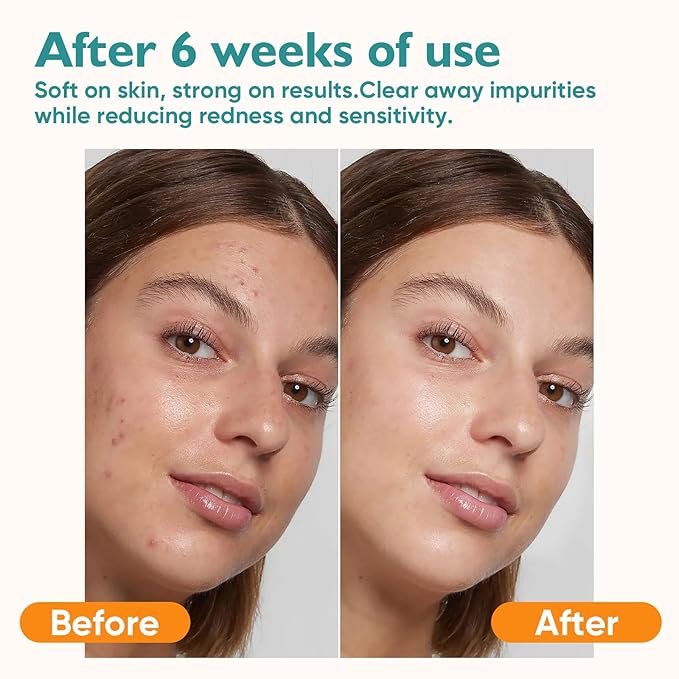 Face Towels, 400 Count Disposable Face Towelette for Washing Face, Skincare, Ultra Soft Facial Towel for Sensitive Skin, Lint-free Makeup Remover Dry Wipes - 8 Box