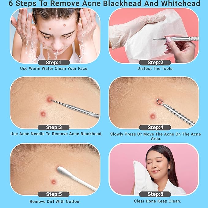 EFAH Care 2Pcs Stainless Steel Pimple Extractor Acne Treatment Tool Surgical Blemish Grade Blackhead Remover Perfect for face and Nose Easy to Clean (Silver)