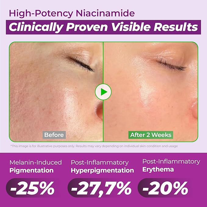 JUMISO Niacinamide 20% Face Serum, Dark Spot & Uneven Tone Care, TXA + Glutathione, Pore & Oil Control for Glass Skin, Centella Soothing, Korean Skincare, 1.35 fl oz 2 Pack