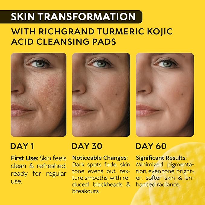 Turmeric Kojic Acid Cleansing Pads for Face - Exfoliating Sponges with Vitamin C & Lemon - Foaming Facial Wash for Glowing Skin & Uneven Tone Support - Gentle Daily Scrub