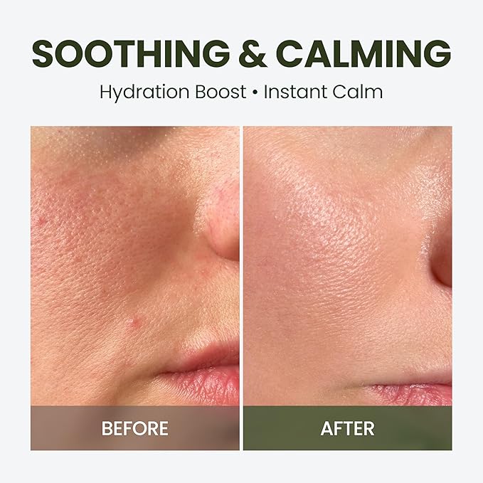 HyCicaMue Green Face Mist | Ultra-Fine Face Spray for Instant Calming & Moisturizing | Cica, Peptide, Ceramide, Hyaluronic Acid | Reduce Excess Sebum & Soothe Irritated Skin | Korean Skin Care