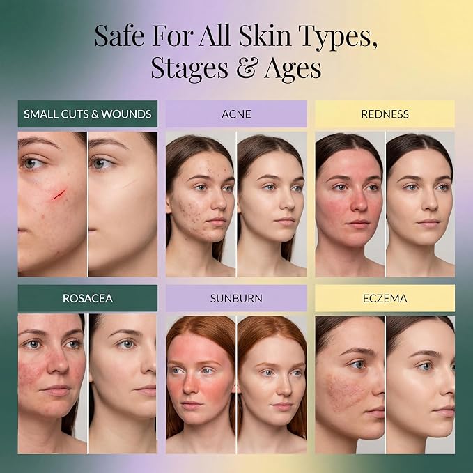 Jusspray™ Hypochlorous Acid Spray for Face and Skin | HOCI Facial Cleanser Mist | 8 oz Hypochlorous Acid for Face, Skin, Acne, Eczema, Body Acne Sprays, Piercing Aftercare, Wound Solution