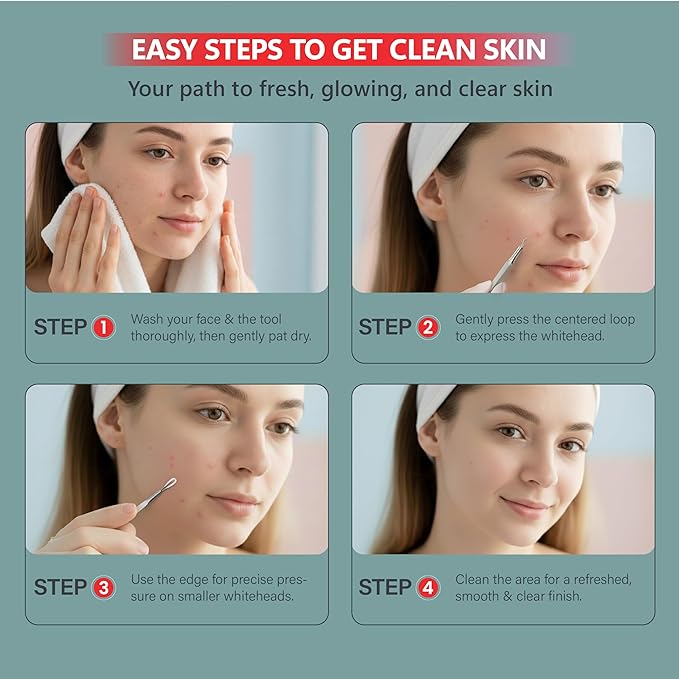 Suvorna Skinpal s25 - Whitehead & Blackhead Remover, Cleaner & Comedone Extractor 2 in 1. Made of Dermatologist Grade Surgical Steel. Approved by Best aestheticians, Comes with Product Guide & Pouch.