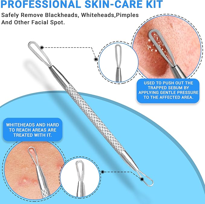 EFAH Care 2Pcs Stainless Steel Pimple Extractor Acne Treatment Tool Surgical Blemish Grade Blackhead Remover Perfect for face and Nose Easy to Clean (Silver)