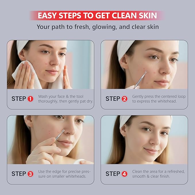 Suvorna White Head Remover for Face, Pimple Extractor, Pimple Popper, Whitehead Remover for Face, Comedone Extractor Tool, Pimple Extractor Tool, Pimple Popper Tool.