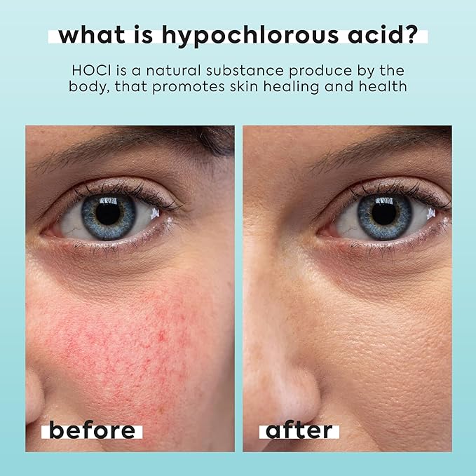 2 Pack Hypochlorous Acid Spray for Face & Body - 2 x 3.4 fl oz - Helps Reduce Redness and Breakouts - Multi-Purpose Travel Size Hypochlorous Spray - Topical Facial Skin Repair - pH-Balancing Toner