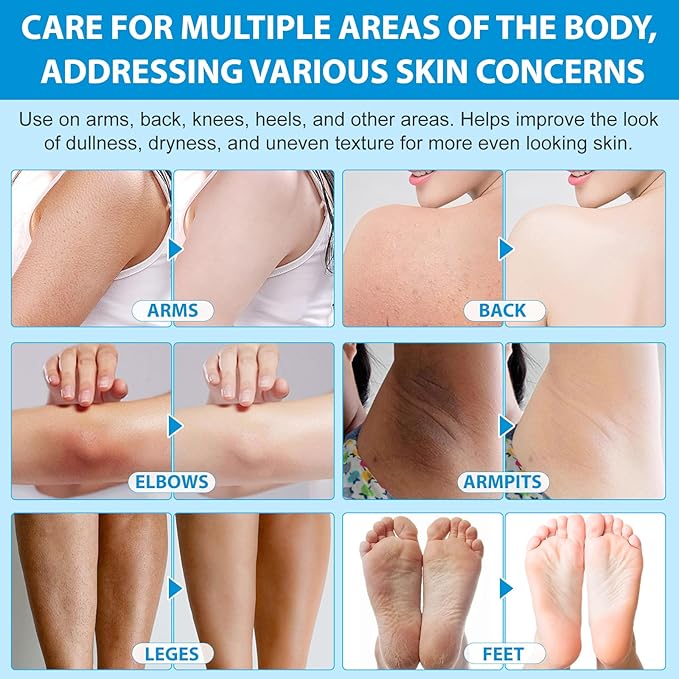 Exfoliating Body Stick with AHA 7% + BHA 0.5% — Smooth & Soft Skin Formula — Solid Non-Messy Texture — With Shea Butter for Nourishing Care — For Arms, Legs, Inner Thighs, Underarms & Rough Areas
